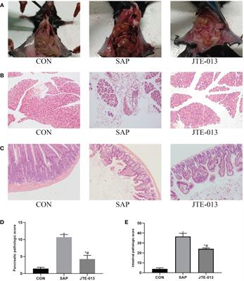 S1PR2 participates in intestinal injury in severe acute pancreatitis by regulating macrophage pyroptosis